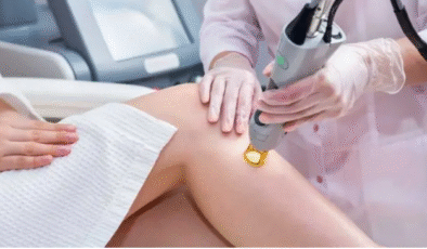 Lazer epilasyon gerçekten kalıcı sonuçlar sağlar mı?