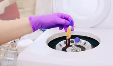 PRP Tedavisi Nedir, Nasıl Yapılır, Ne İşe Yarar?