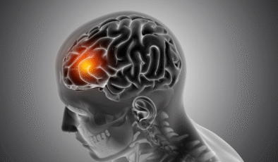 Beyin Ve Sinir Cerrahisinde Modern Tedavi Yöntemleri